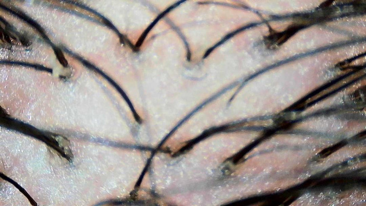 قبل از استفاده از اسکراب کف سر