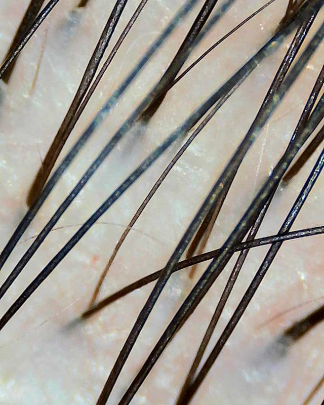 بعد از استفاده از اسکراب کف سر