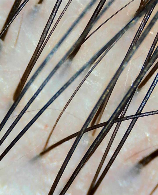 بعد از استفاده از اسکراب سر