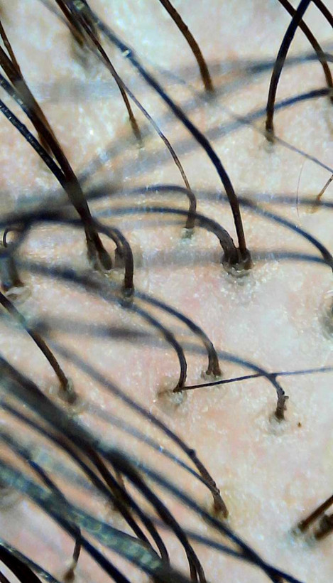 قبل از استفاده از اسکراب کف سر